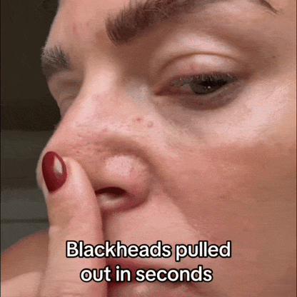 Peel Shot Blackhead Remover